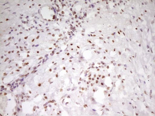 MEF2D Antibody (aa1-282, clone OTI10B4)