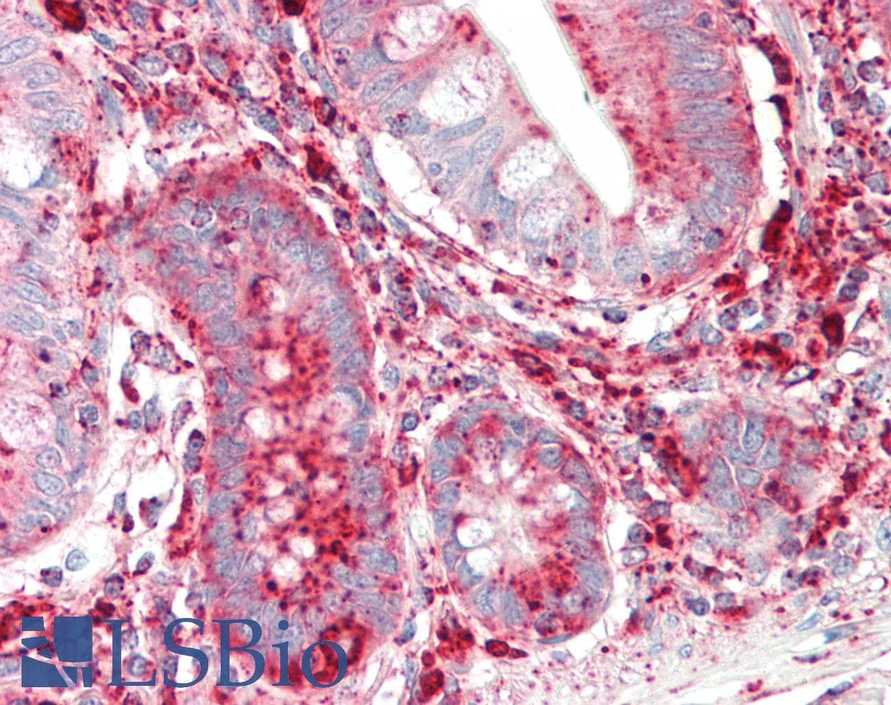 IHC-plus™ LAMP1 / CD107a Antibody (clone 6E2)