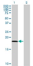RARRES3 Antibody (clone 1H5)