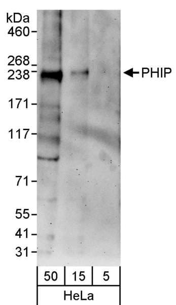 WDR11 / PHIP Antibody (aa1600-1650)