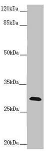 Polyclonal Rabbit anti-Human CENPH / CENP-H Antibody (IHC, WB)