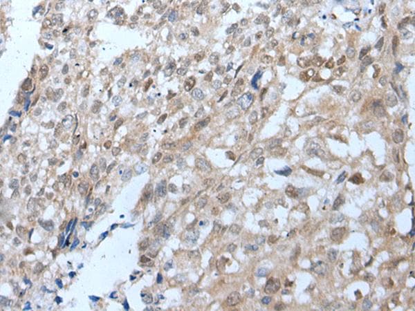 Polyclonal Rabbit anti-Human VPS35 Antibody (IHC, WB)