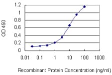 AAMP Antibody (clone 2H2)