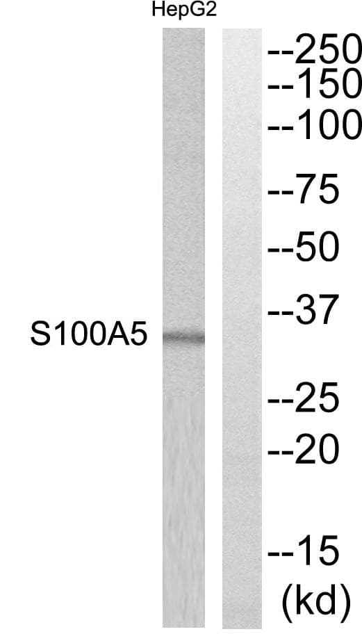 S100A5 Antibody