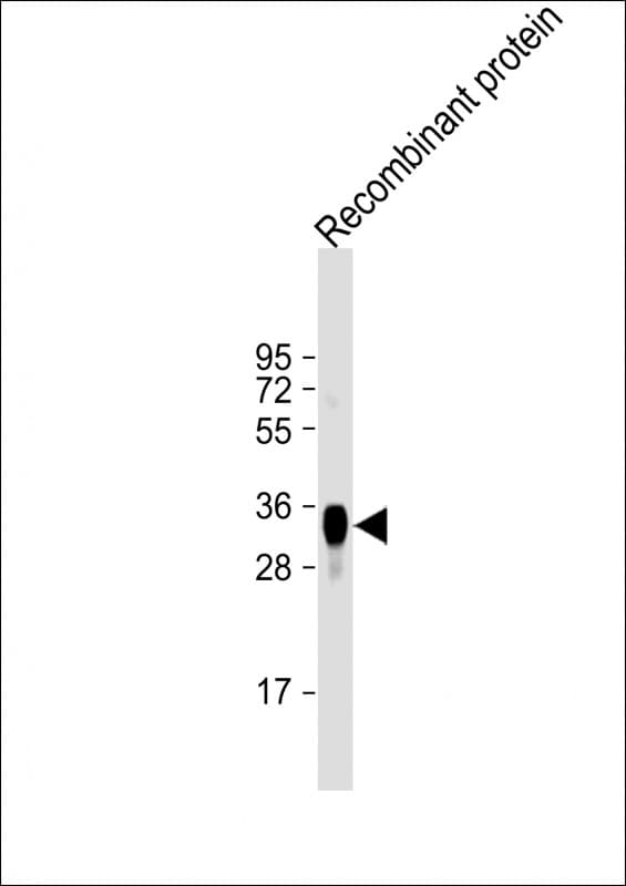 LRP1B Antibody (clone 1642CT247.63.22)