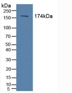 ABCC2 / MRP2 Antibody (aa1300-1534, APC)