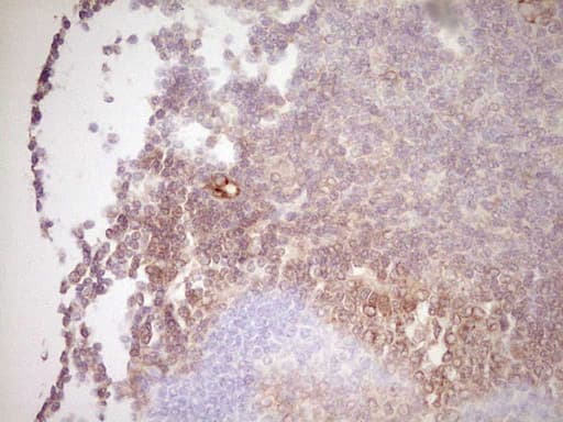 UBE2D2 / UBCH5B Antibody (clone OTI1A9)
