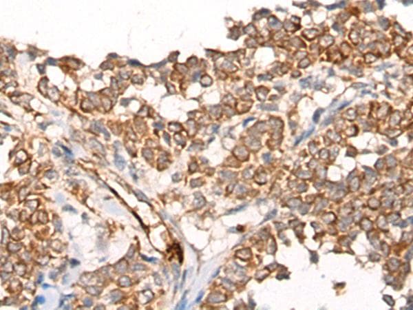CA-VB / CA5B Antibody