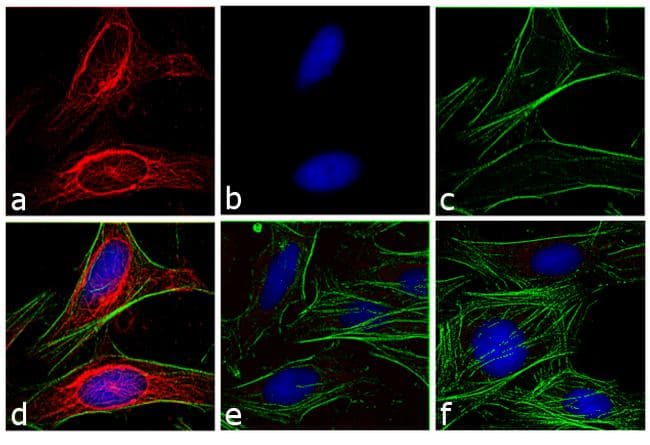 Polyclonal Goat Anti-Mouse IgG Secondary Antibody (DY594, IHC, IF, WB)