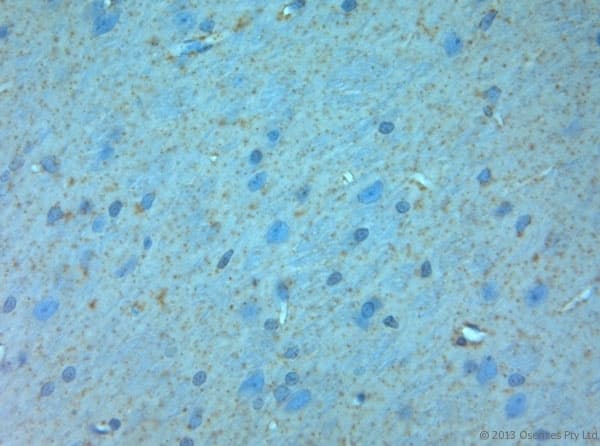 Polyclonal Rabbit anti-Rat GRIN3A / NR3A Antibody (aa1091-1135, IHC)