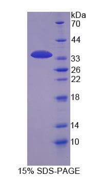 Bovine KERA / Keratocan Protein (Recombinant His-S)