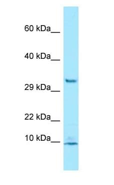 PDE6G / PDE6 Gamma Antibody (aa19-68)