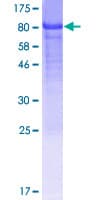 Human TOR1AIP2 Protein (Recombinant GST)