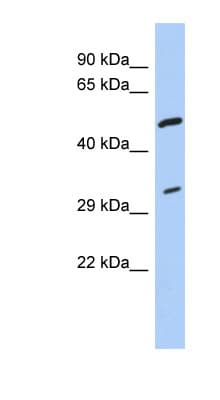 Polyclonal Rabbit anti-Human TPM3 Antibody (aa143-192, WB)