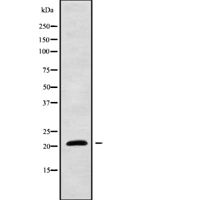 CYBA / p22phox Antibody