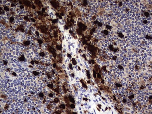S100A9 / MRP14 Antibody (clone OTI7B1)