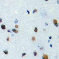 TEF Antibody (C-Terminus)