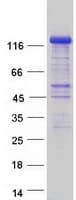 Human FNIP2 Protein (Recombinant Myc-DDK (Flag))