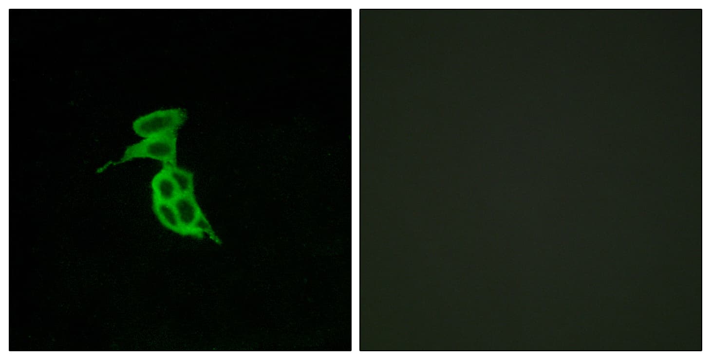GPR143 Antibody (aa151-200)