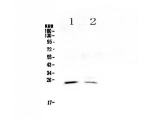 Polyclonal Rabbit anti-Human STAR Antibody (WB)