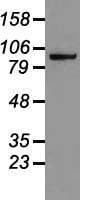 CTNNB1 / Beta Catenin Antibody (clone OTI2D11)