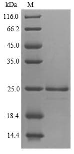 Avena sativa Endochitinase Protein (Recombinant 6His, N-terminus + Myc, C-terminus)