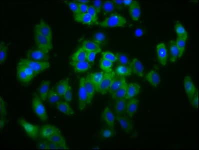 Polyclonal Rabbit anti-Human SLC5A4 / SGLT3 Antibody (IF)