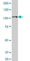 HK2 / Hexokinase 2 Antibody (clone 4H1)