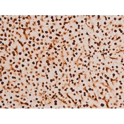 Polyclonal Rabbit anti-Human SYK Antibody (phospho-Tyr348, IHC, IF, WB)