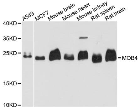MOB4 / PHOCN Antibody