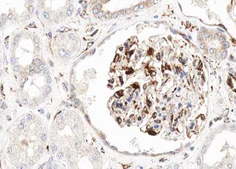 CDH13 / Cadherin 13 Antibody