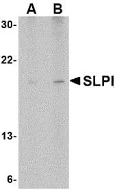 SLPI / Antileukoproteinase Antibody