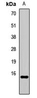 Polyclonal Rabbit anti-Human HBA2 / Hemoglobin Alpha 2 Antibody (IHC, WB)