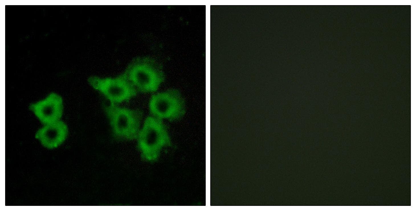 APLNR/ Apelin Receptor / APJ Antibody