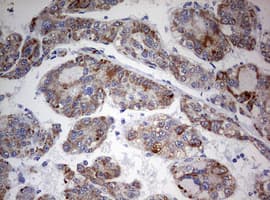 FEN1 Antibody (aa117-380, clone OTI1F3)