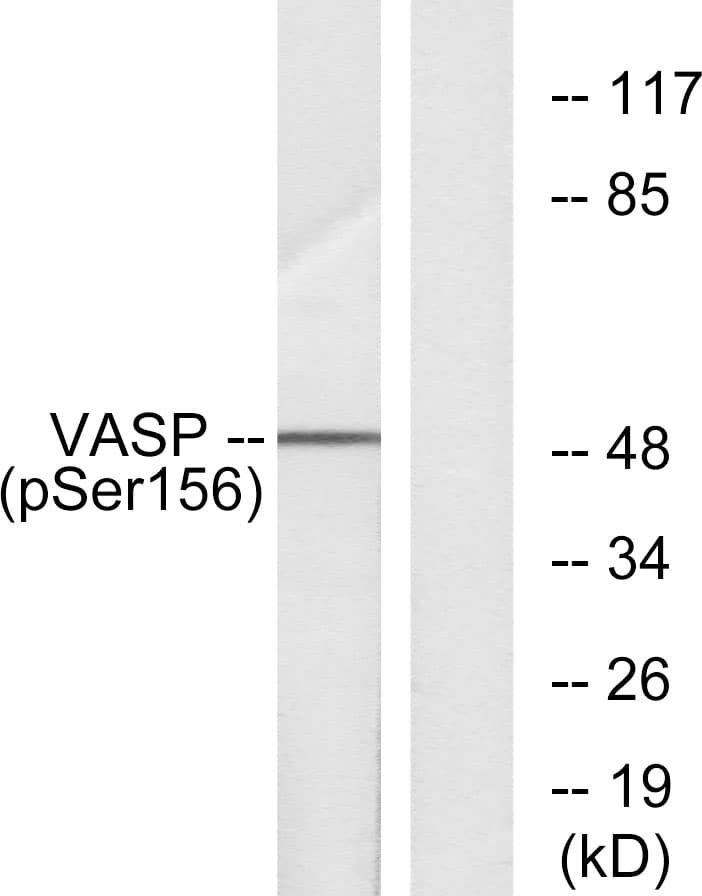 VASP Antibody (phospho-Ser157)