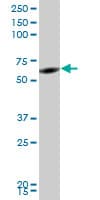 RNF2 / RING2 / RING1B Antibody (clone 2B6)