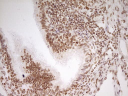 NR2C2 / TAK1 Antibody (aa1-241, clone OTI1F3)