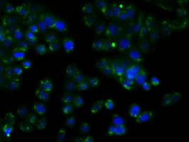 RDH11 Antibody (clone OTI1B4)
