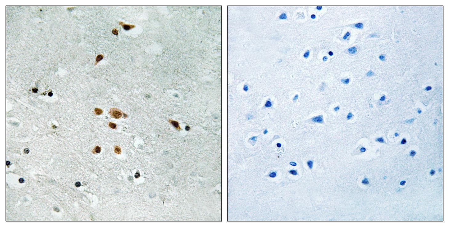 FER Antibody (phospho-Tyr402)