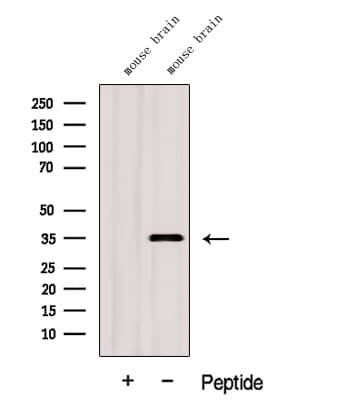 GGPS1 Antibody