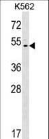 ACCN5 / HINAC Antibody (aa388-414)