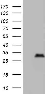 NKX3-1 Antibody (clone OTI2A5)