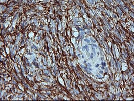 MAP2K1 / MKK1 / MEK1 Antibody (clone OTI6C6)
