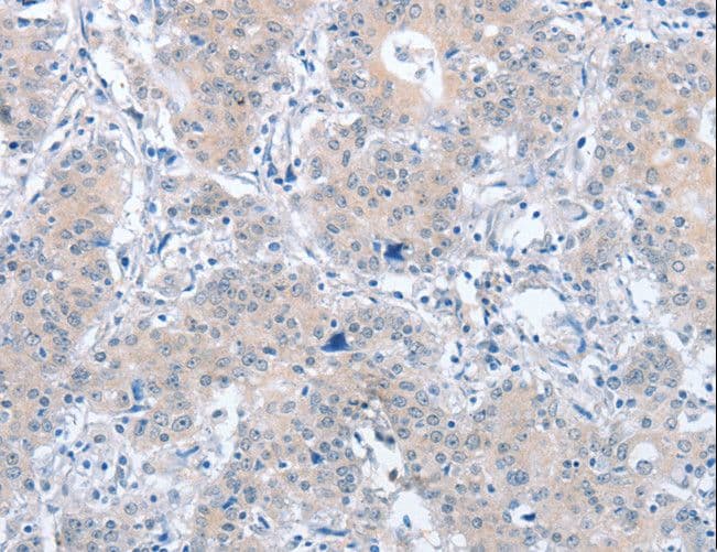 PARD6A / PAR6 Antibody