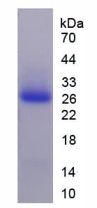 Human AGRN / Agrin Protein (Recombinant 6His, N-terminus)