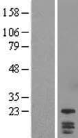 DYDC1 Protein (Over-Expression Lysate Myc-DDK (Flag))