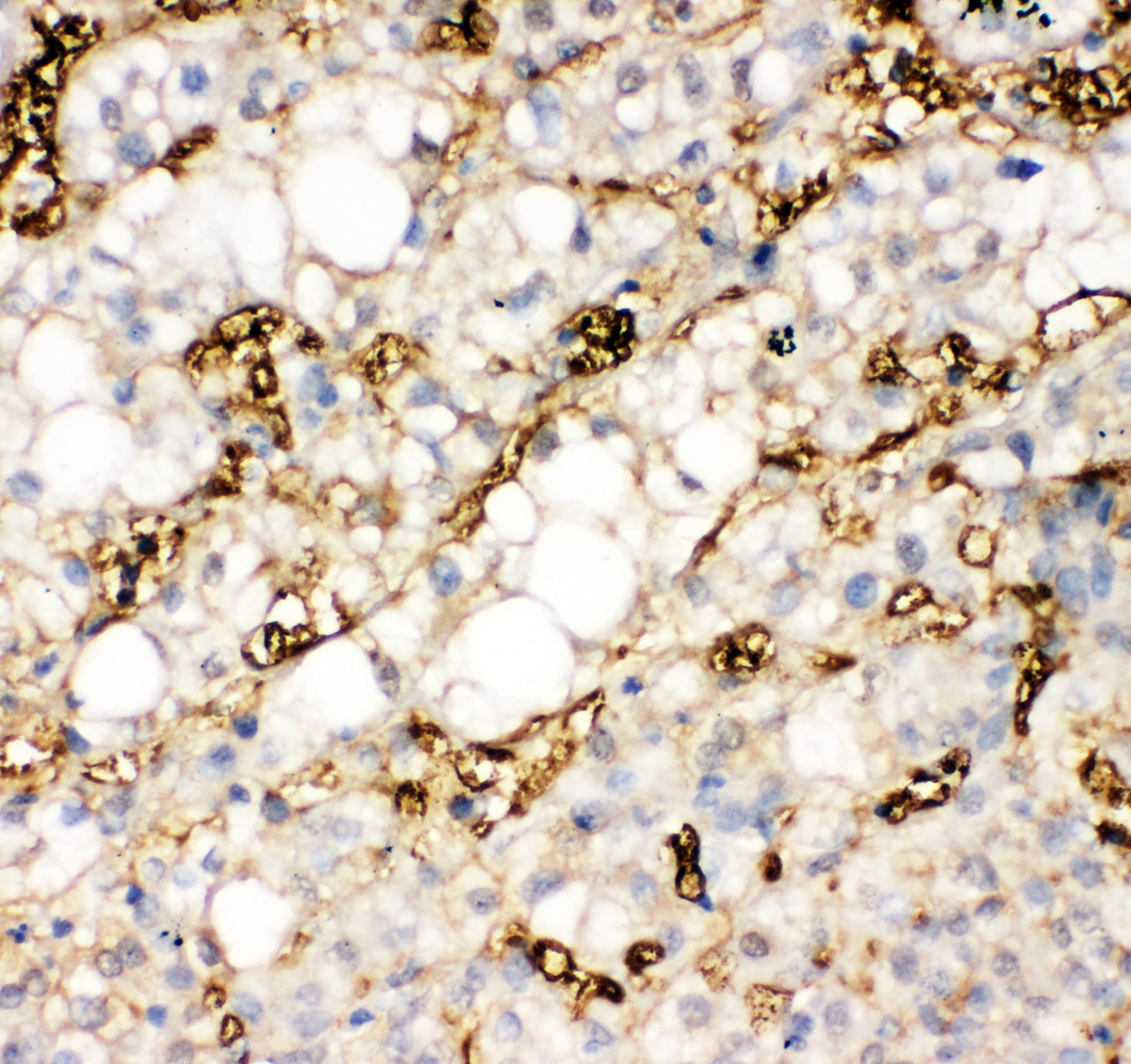 FABP1 / L-FABP Antibody (aa30-46)