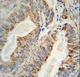 Monoclonal Mouse anti-Human AKT2 Antibody (aa214-451, IHC, IF, WB)