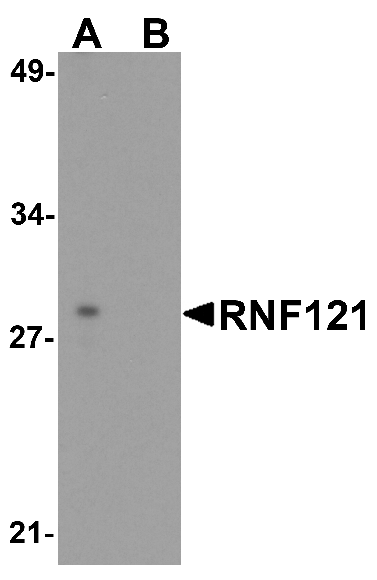 IHC-plus™ RNF121 Antibody